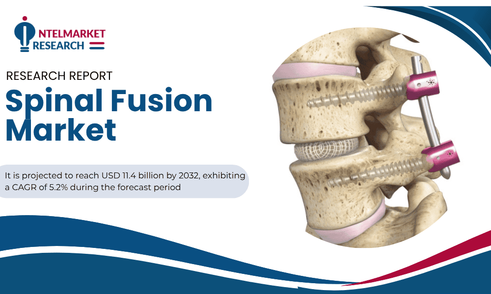 Spinal Fusion Market Size Set to Surpass USD 11.4 Billion by 2032 | Key Drivers & Growth Insights