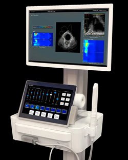 Global Advanced Vaginal Tactile Imaging (VTI) Market Overview