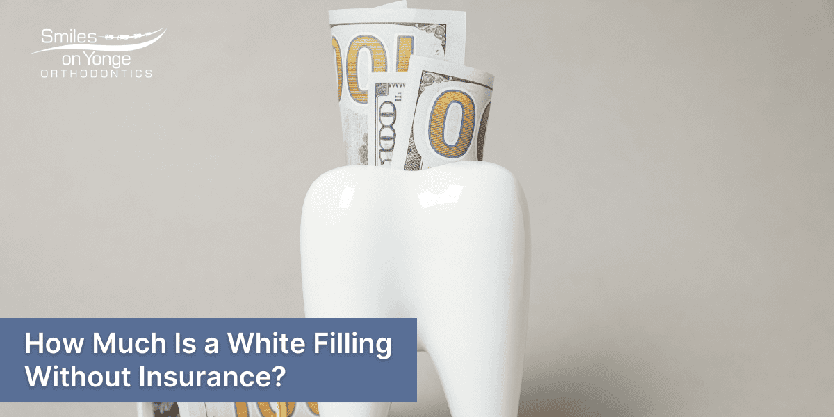 How Much Is a White Filling Without Insurance?