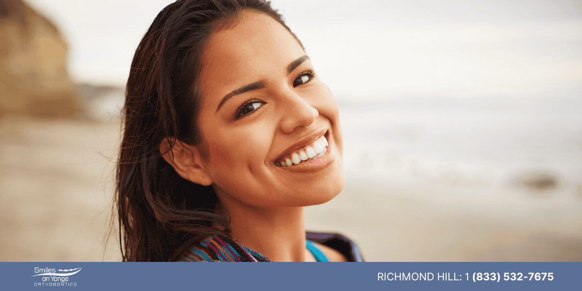 Can you whiten teeth with fillings