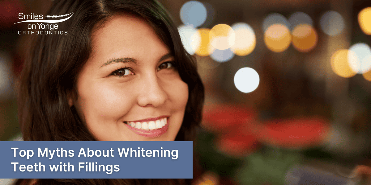 Myths about whitening teeth with fillings