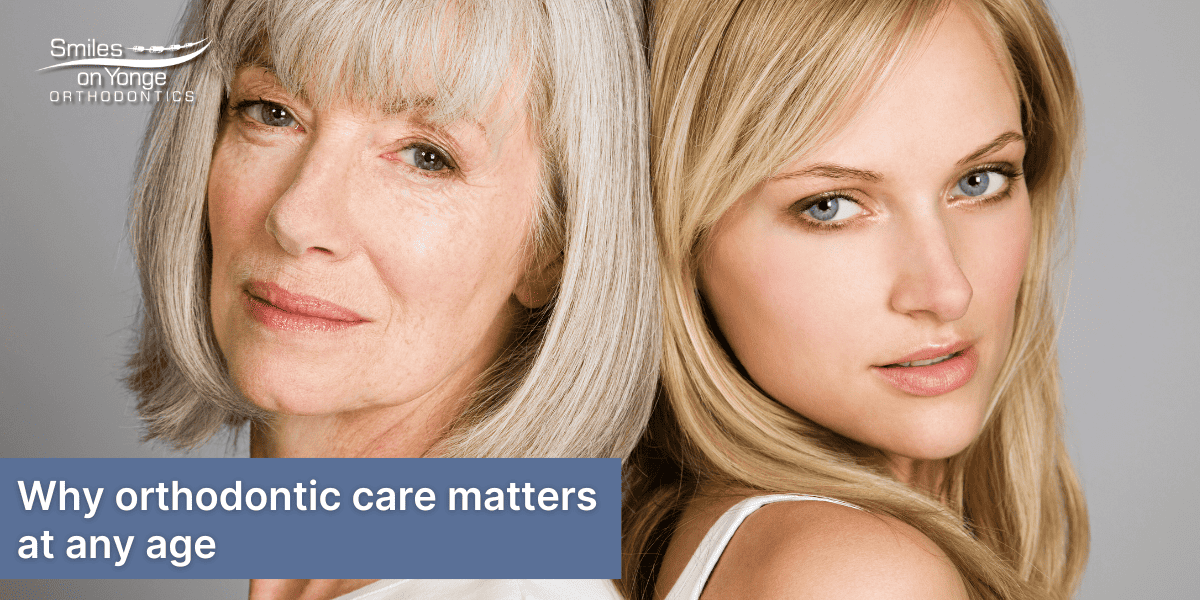 Why age is not a deciding factor for orthodontic care
