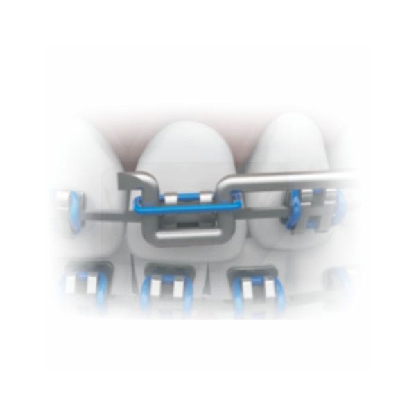 Aplicador/Extrator de Ligadura - Imagen 3