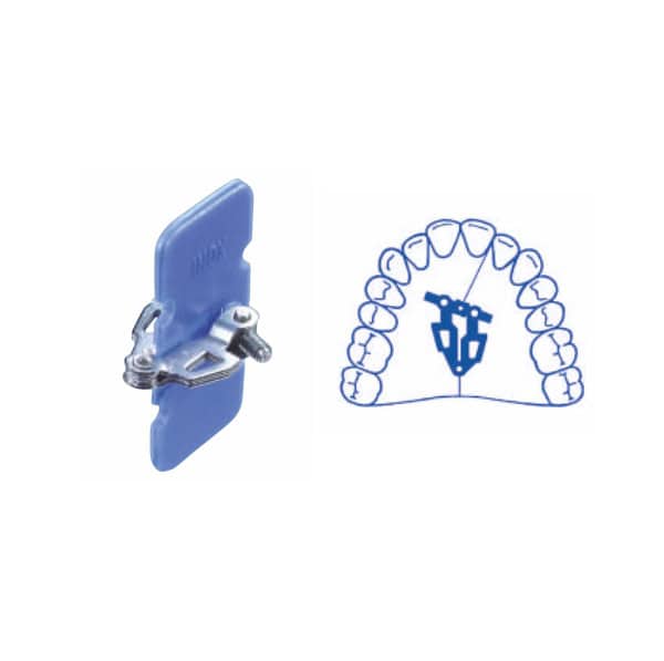 Tornillo de expansión abanico asimétrico