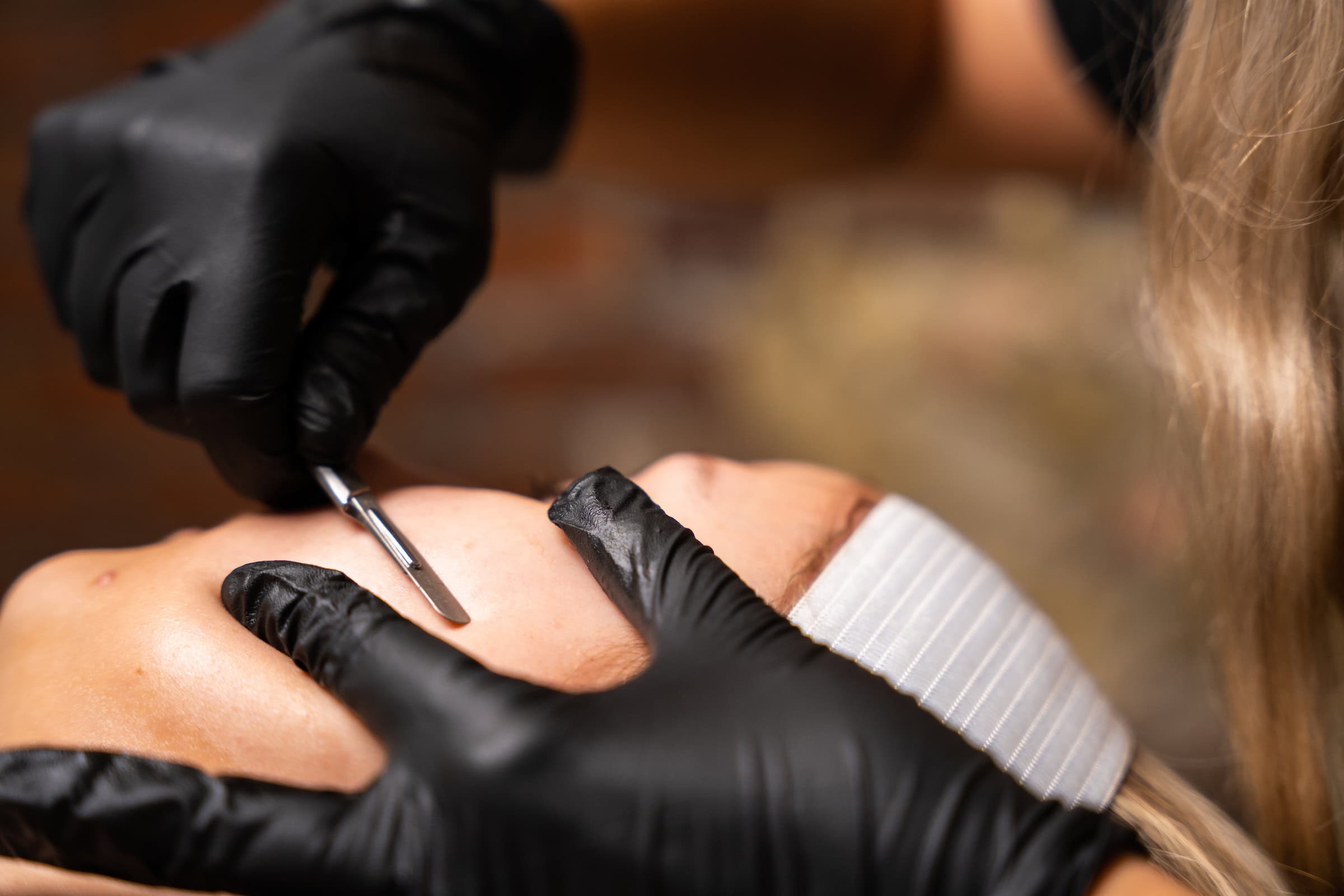 Dermaplaning