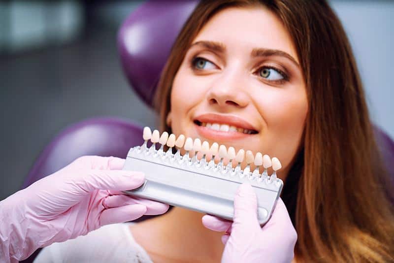 Veneers Richmond Hill