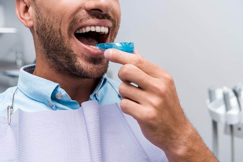 Mouthguards Richmond