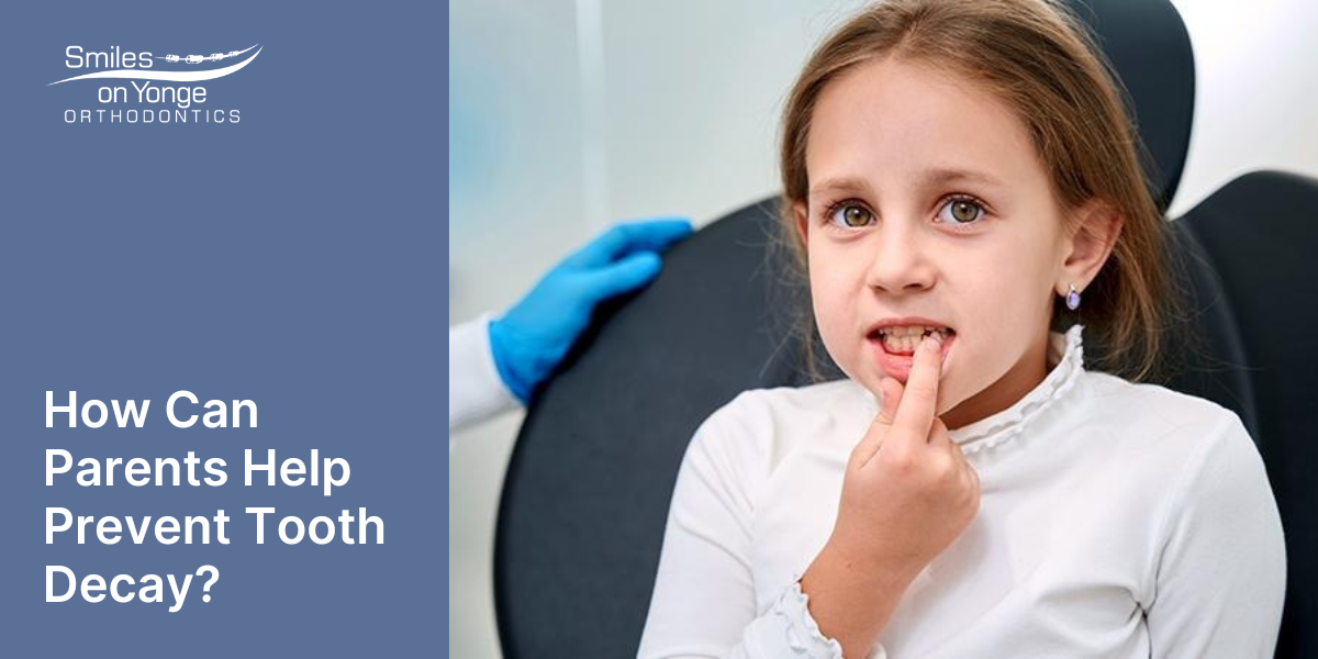 How Can Parents Help Prevent Tooth Decay?