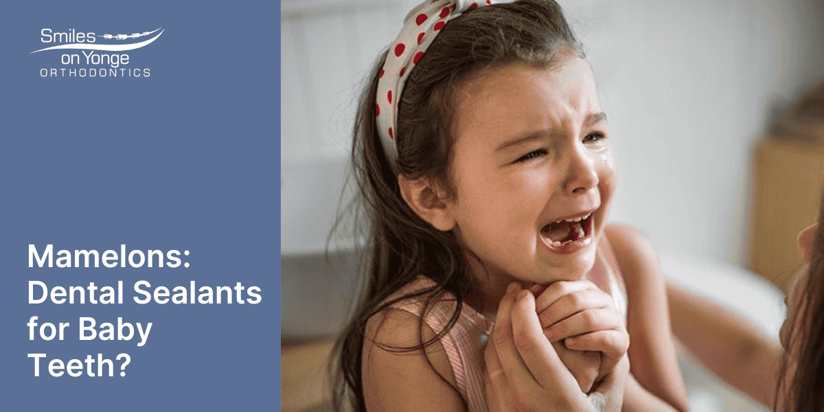 Mamelons: Dental Sealants for Baby Teeth?