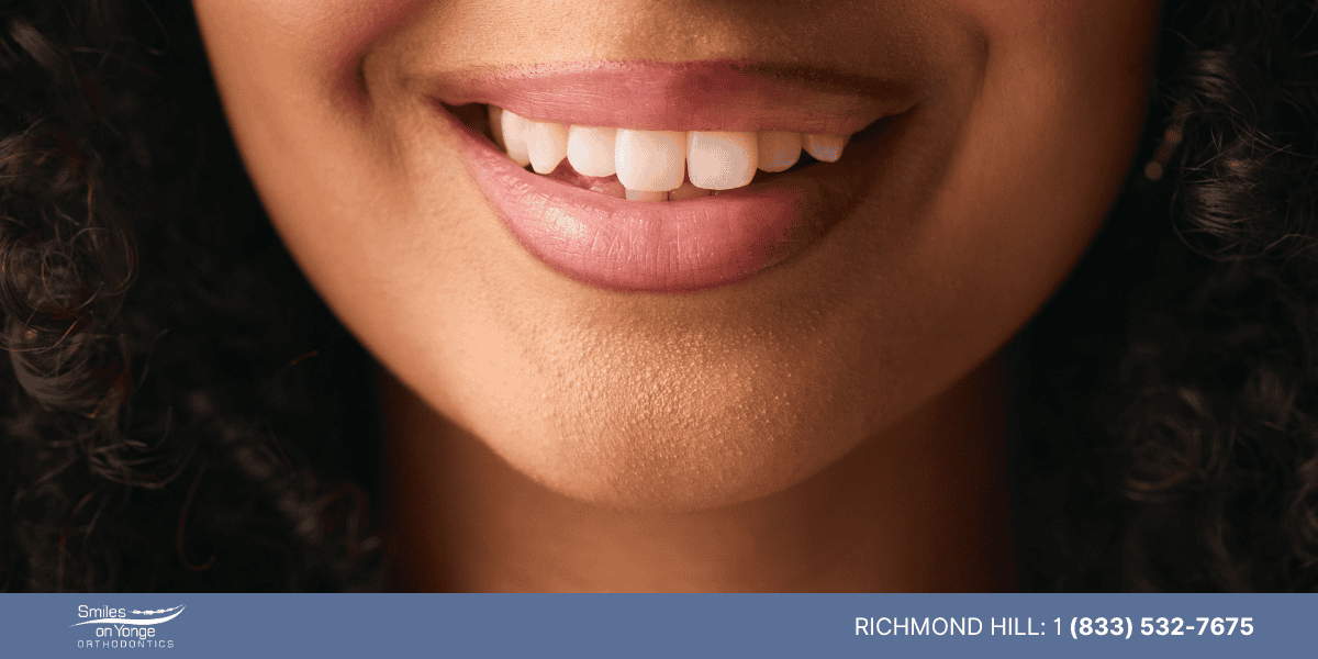 Smiles on Yonge Dental Filling Experience