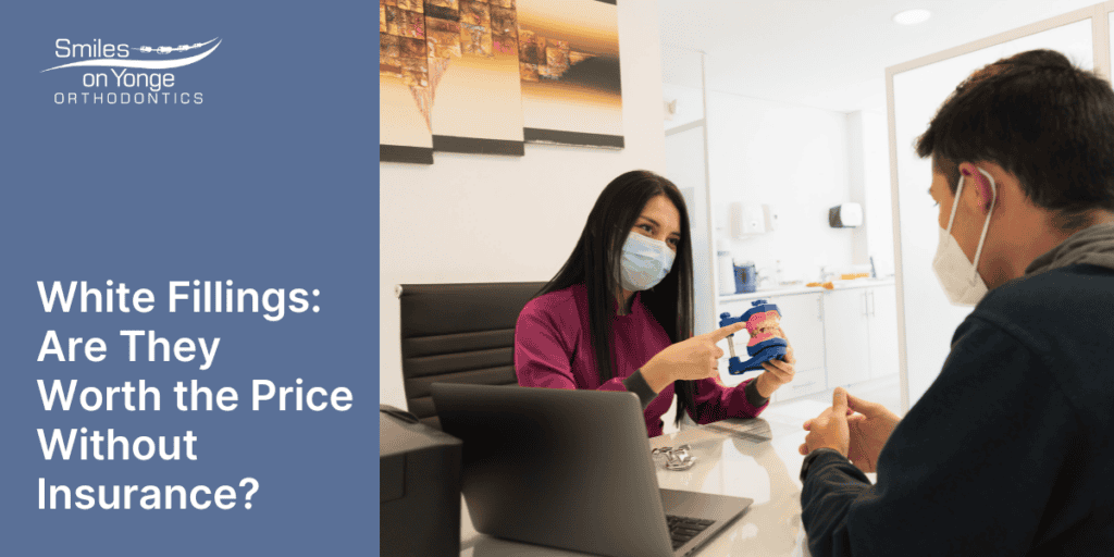White Fillings: Are They Worth the Price Without Insurance?