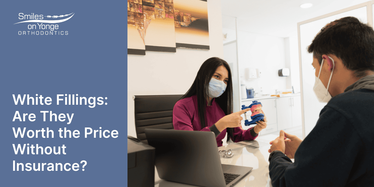 White Fillings: Are They Worth the Price Without Insurance?