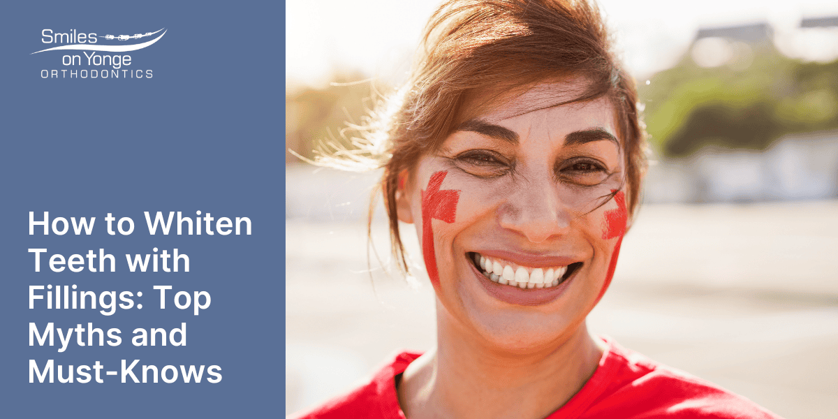 how to whiten teeth with fillings