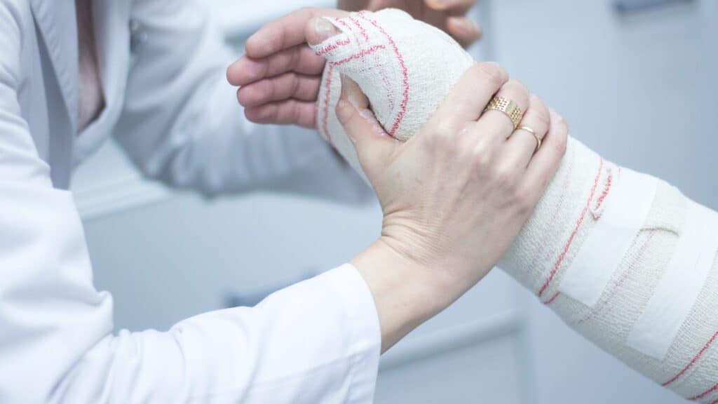 cast on a arm and hand