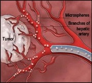 Minimally Invasive Treatments