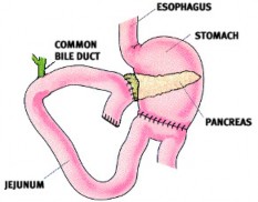 Biliary and Pancreatic Treatments