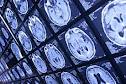 radiology Comments/Questions