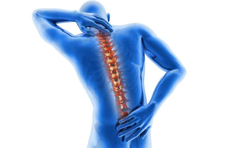 Spinal Injuries in Florida Accidents: Neck or Back Pain