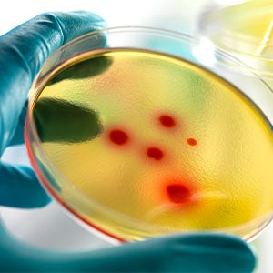 Maintaining Quality in Stem Cell Products: Quality Control Considerations (Series Part 3 of 4)