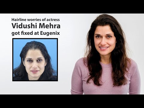 Female Hair Restoration, | Fixing of Hairline of Actress Vidushi Mehra | Eugenix Hair Sciences