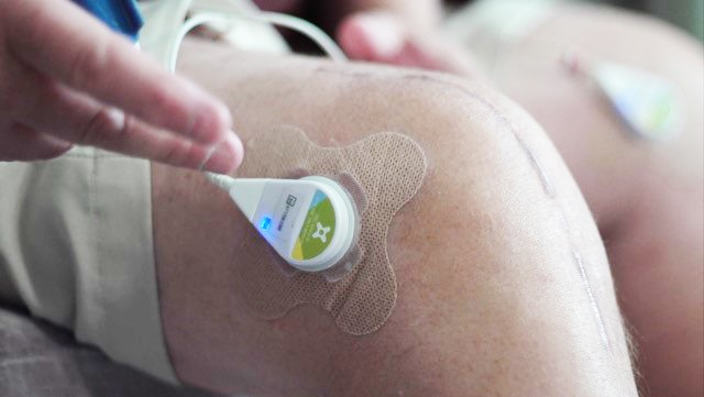 Wearable Ultrasound