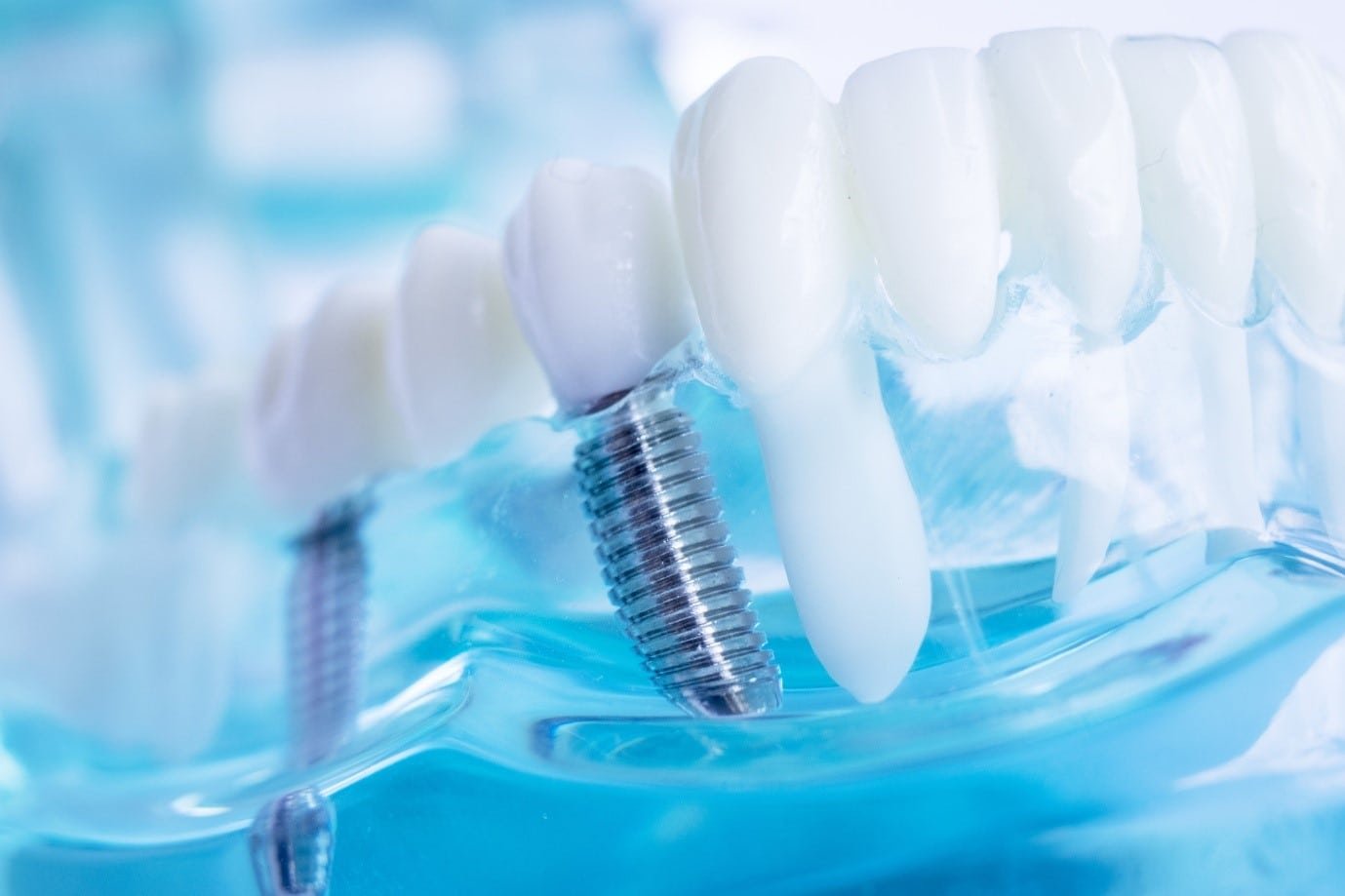 Dental