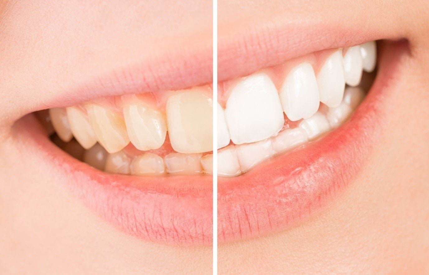 Teeth