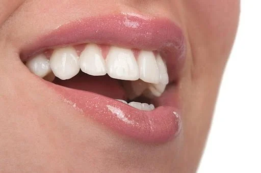 The Different Types Of Smile Transformation Treatments