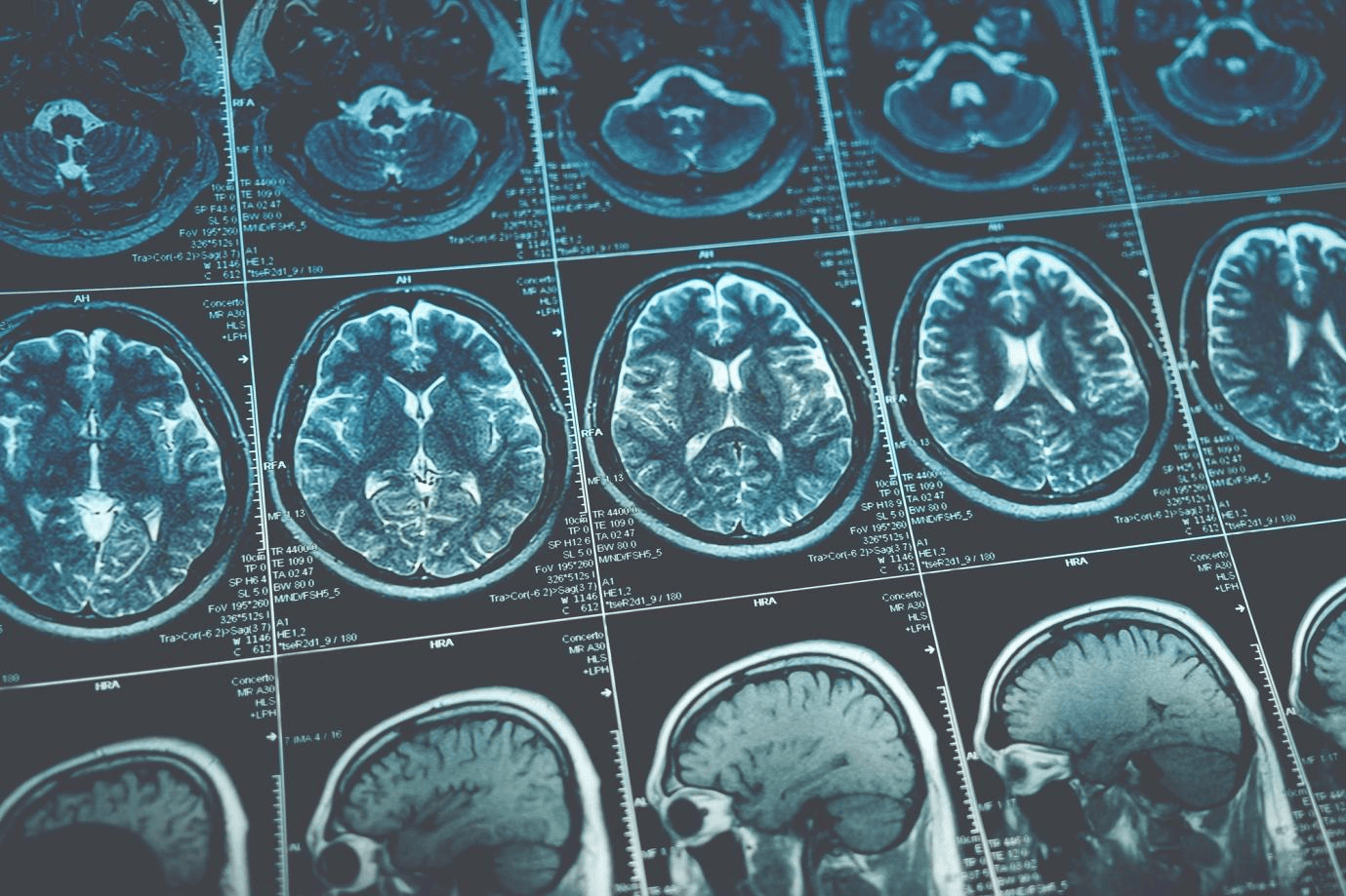 Head Injury Assessment And Management: Everything To Know