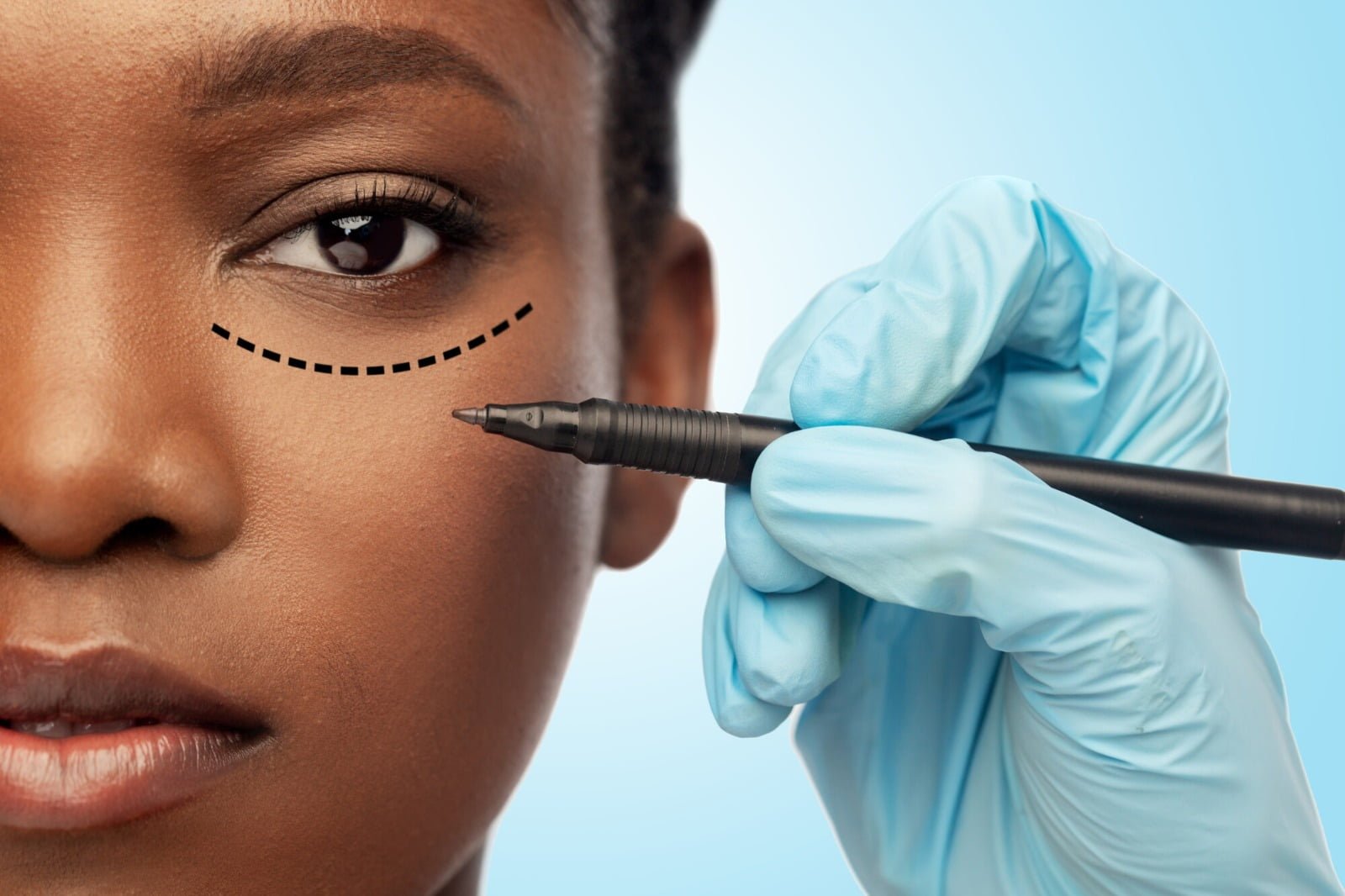 Errors In Choosing Facelift Surgeons
