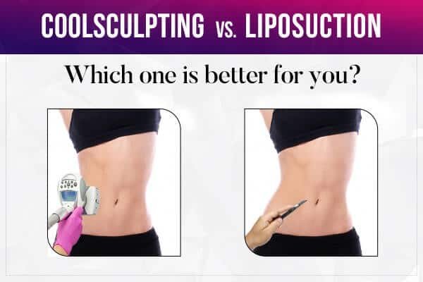 Lipo Laser Vs Coolsculpting: Which Is Right For You? 1