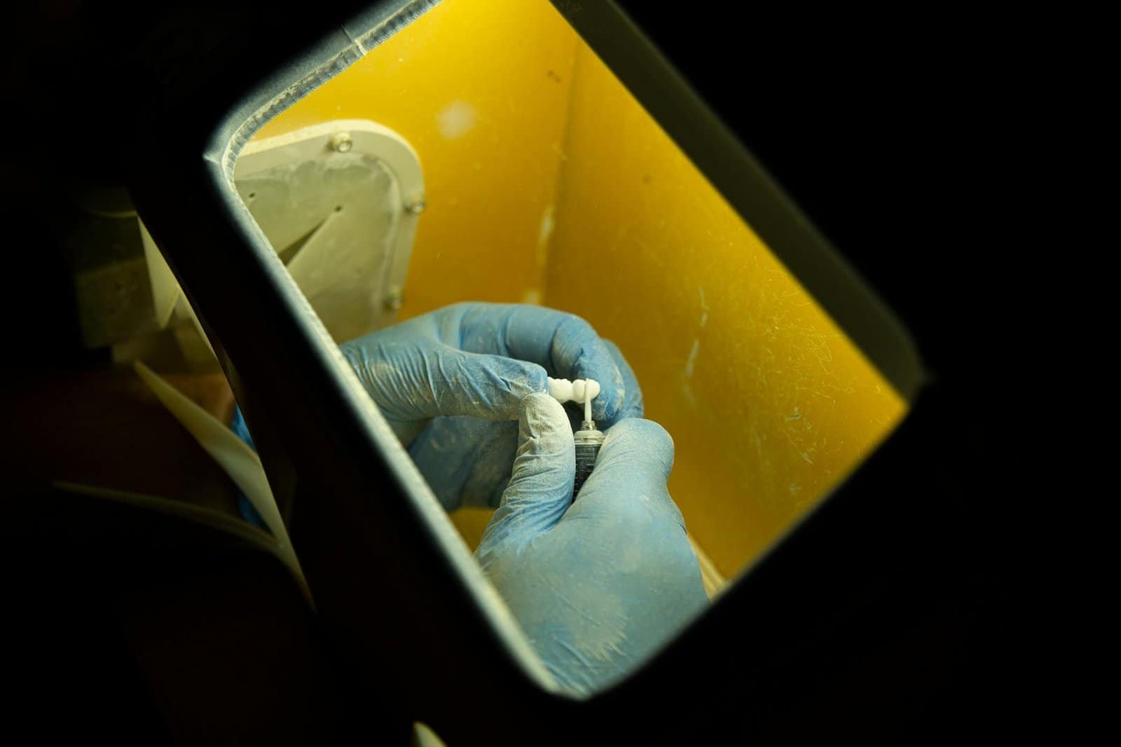 Dental Implants Procedure