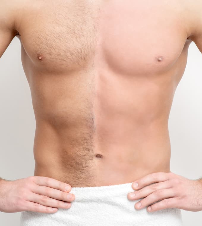 Img-Srv-Epilazione-Uomo