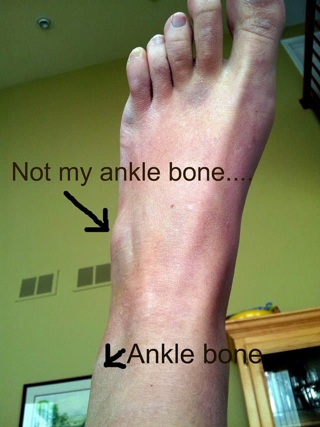 Sprained foot Saturday