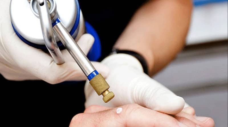 Crioterapia Paderno Dugnano