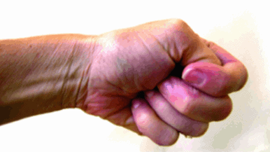 DeQuervain’s Tenosynovitis featured