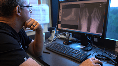 Double Bunionectomy Surgery Featured