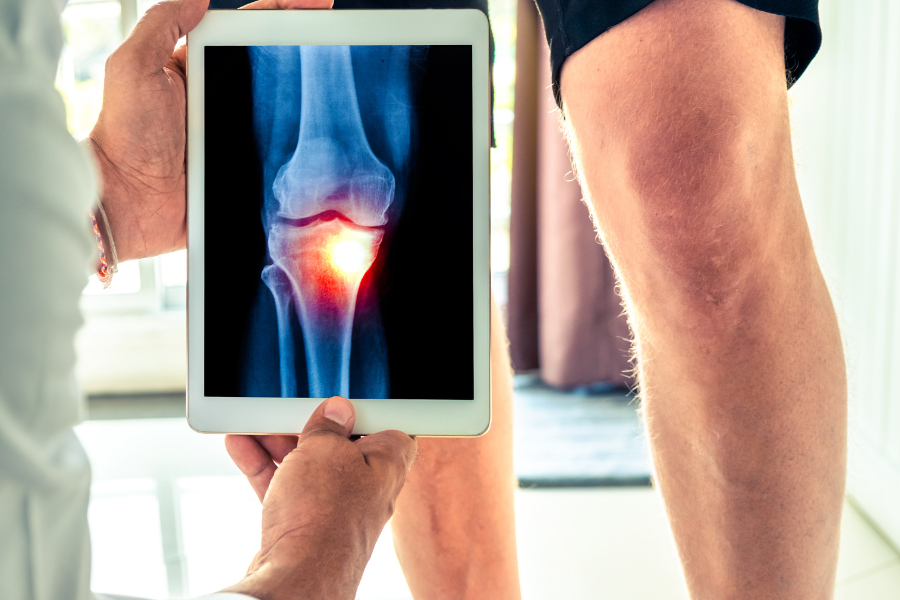 understanding knee surgery