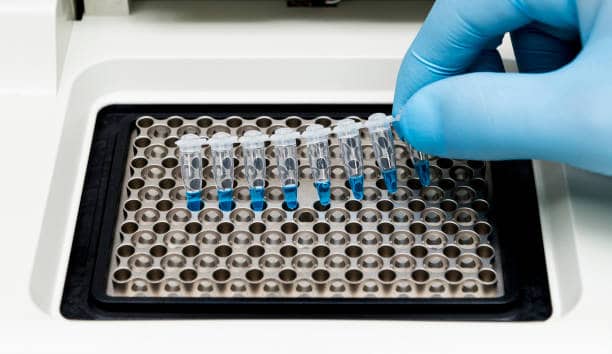 China NGS Sample Preparation Market Innovations: Trends and Strategic Opportunities