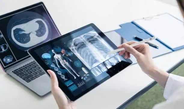 China Digital Mobile X-ray Devices Market Pathways: Comprehensive Analysis of Size, Share, and Growth Trends until 2035