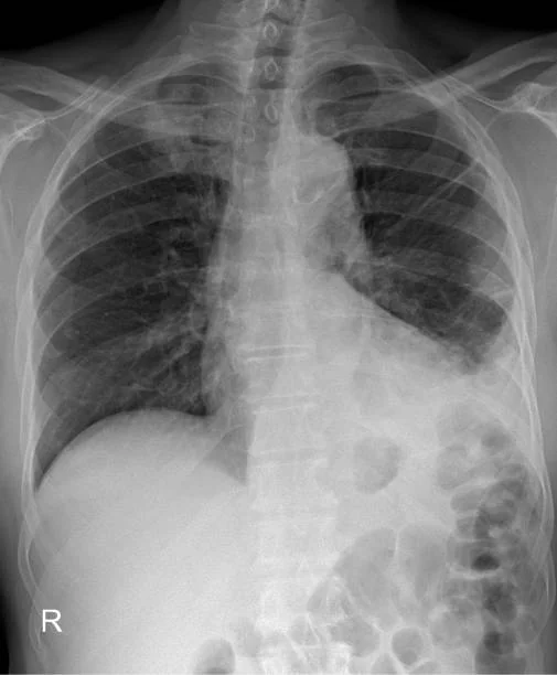 USA Radiography Acquisition Systems Market : Emerging Innovations (2025-2035) – A Comprehensive Report