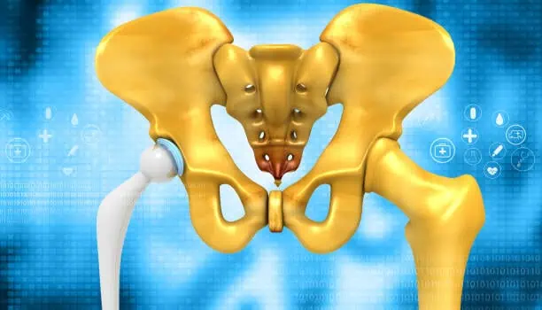 U.S. Artificial Hip Joint Market Dynamics & Strategic Recommendations for 2025-2035