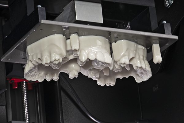 Crown and Bridge Models Printed on a Rapid Shape PRO 20