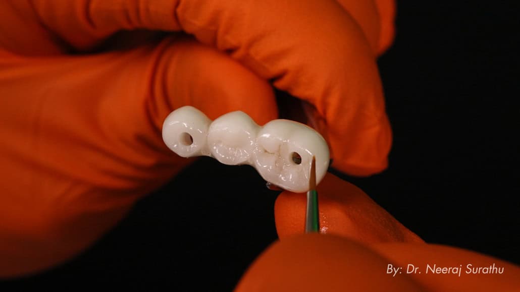 Characterization of 3D printed implant restoration using a stain and glaze system for a natural-looking application