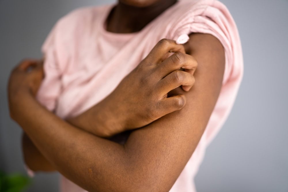 What is the relationship between Menopause and Allergies?