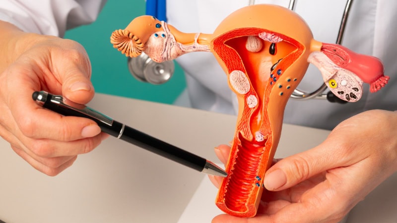 Menopause