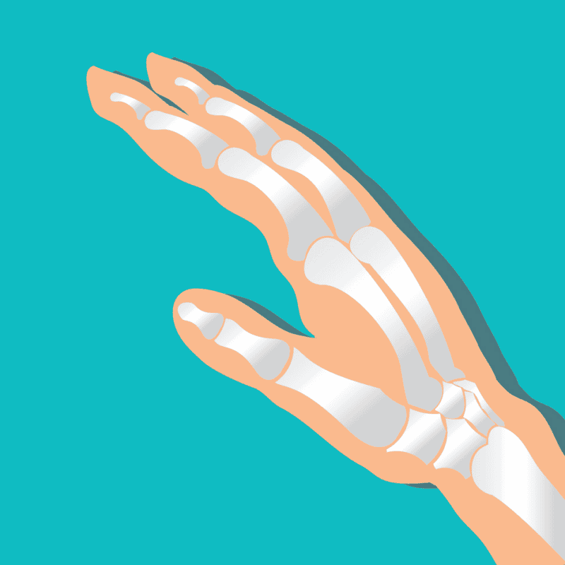 An image that shows Wrist